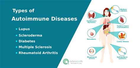 Autoimmune Diseases Common Symptoms Treatment In India Advancells