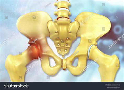 Human Hip Anatomy Femoral Head Pain Stock Illustration 2276193579