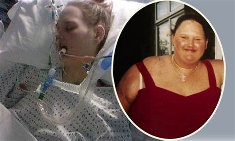 Malissa Jones Once Britain S Fattest Teenager Now Battling Anorexia