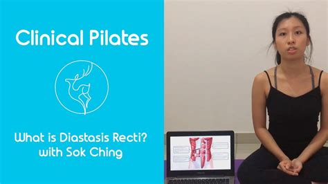 Clinical Pilates 05 What Is Diastasis Recti Youtube