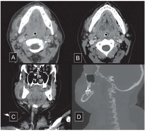 Neuroradiology Head And Neck Radiology Key