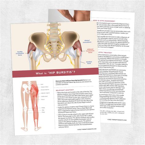 What Is Hip Bursitis Adult And Pediatric Printable Resources For
