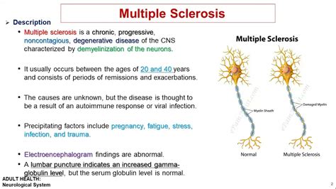 Multiple Sclerosis Causes Symptoms Diagnosis Treatment Pathology Nclex