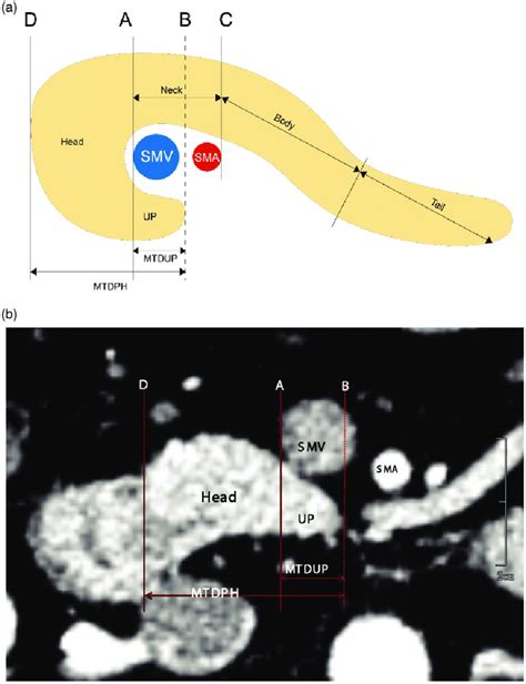 Schematic Drawing Of The Anatomic Segments Of The