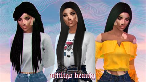 Sims 4 Cas Vitiligo Beauty Full Cc List And Download