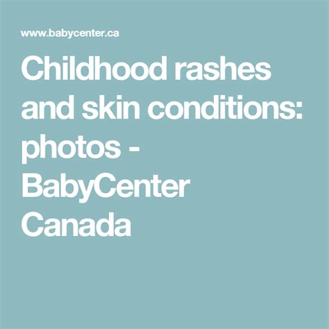Childhood Rashes And Skin Conditions Photos Babycenter Canada Skin
