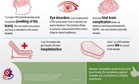 Infographic Measles Is A Serious Disease