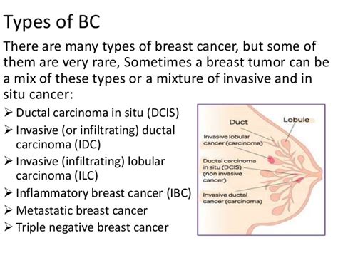 If you require surgery, it can affect their symmetry and may result in scars, changes in shape, or the loss of one or both breasts. Presentation on breast cancer