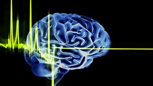 La muerte cerebral es permanente e irreversible. ¿Qué es la muerte cerebral? - BBC News Mundo