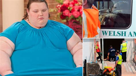 georgia davis former fattest teen in britain was rushed to hospital with severe infection