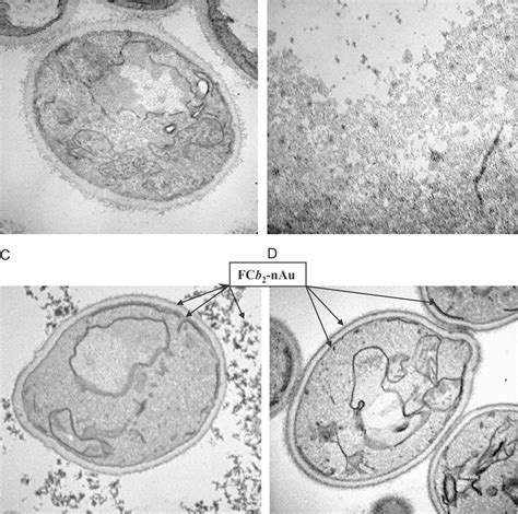 Transmission Electron Microscopy Tem Images Intact Yeast Cells Of H