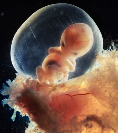 المراجع الحمل يَحدث الحمل عند اختراق الحيوان المنوّي للبويضة؛ فتُغلق البويضة. متى يبدأ نبض الجنين ومتى يمكننا سماعه - عالم حواء مركزي