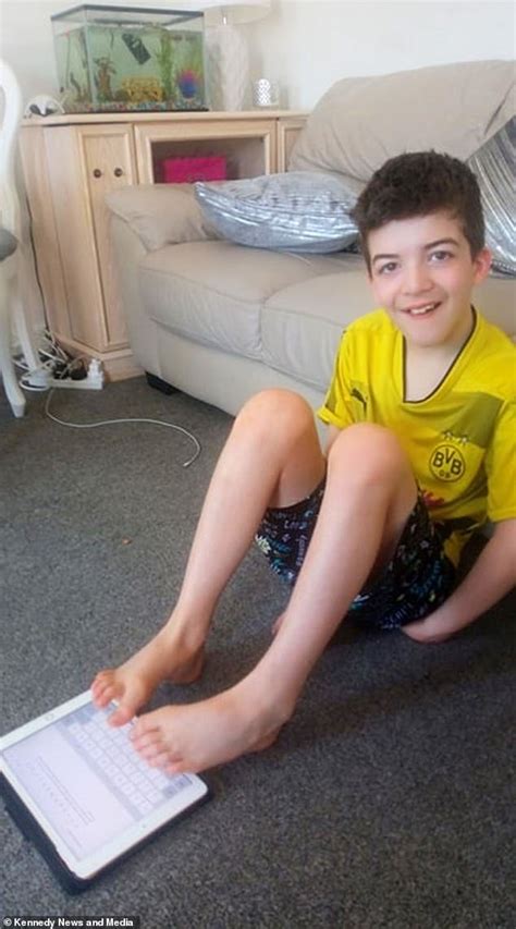Cậu Bé 13 Tuổi Chơi Trò Chơi điện Tử Với Feet Của Mình Sau Khi Bị