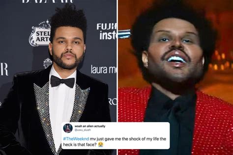 The Weeknd Leaves Fans Scared After Debuting Freaky Face From