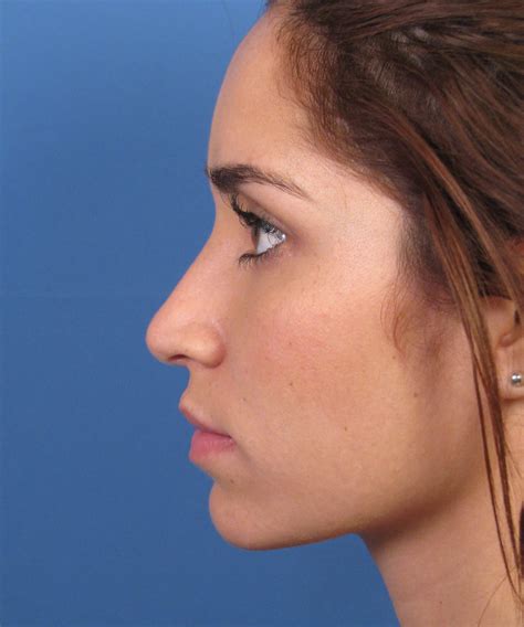 Female Nose Side