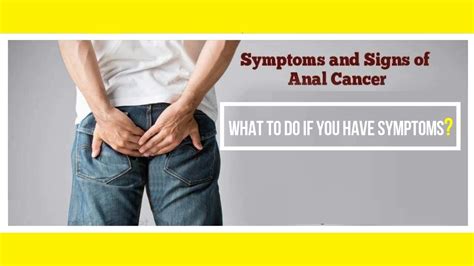 Signs And Symptoms Of Anal Cancer Youtube