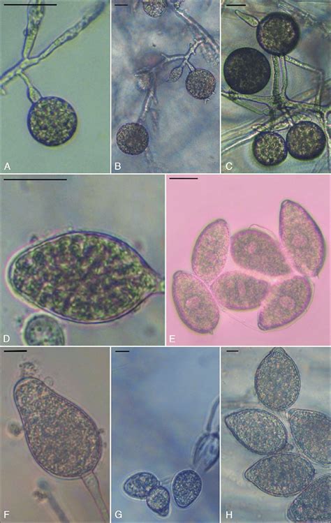 Morphological Data A Terminal Chlamydospore Of P Chlamydospora Bar