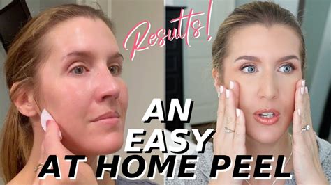 At Home Glycolic Acid Peel That Works Over 40 Skincare Youtube