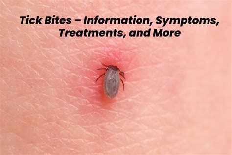 Tick Bites Information Symptoms Treatments And More 2021