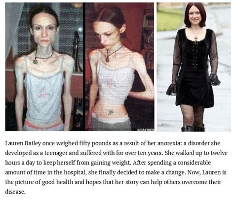 inspiring photos of people who conquered their eating disorders 15 pics