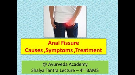 Anal Fissure Causes Symptoms And Signs Diagnosis Treatment L