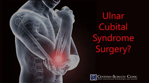 Cubital Tunnel Syndrome Surgery Centeno Schultz Clinic