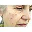 Common Skin Conditions At A Glance  Health Resources Wellness