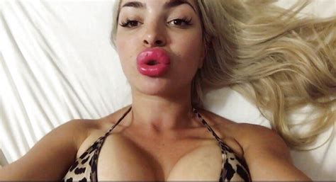 Thick Fake Plastic Bimbo Lips Photo X Vid Com