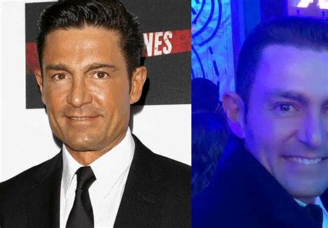 ¿qué Se Hizo El Actor Fernando Colunga En Su Rostro Está