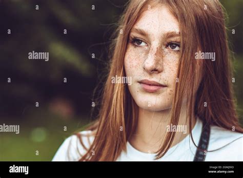 Woman Girl Freckles Close Hi Res Stock Photography And Images Alamy