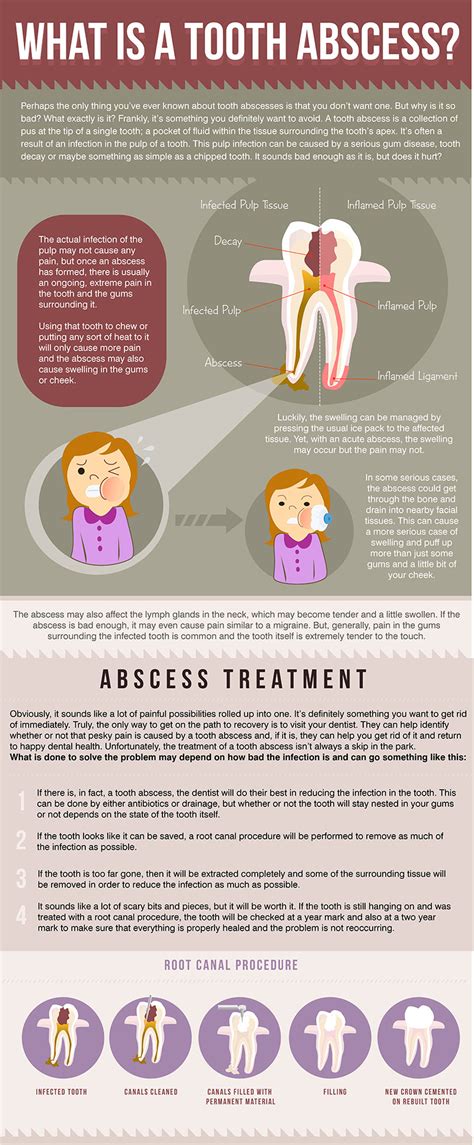 What Is A Tooth Abscess