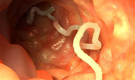 Infection Parasitic Worms Leave Holiday Couple With Rash On Their Bum Uk