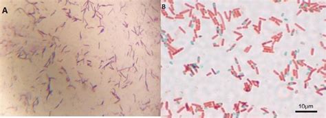 A Strain G9 Grams Staining Gram Positive Rod Shaped Bacteria