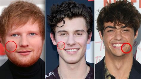 Discover How Your Fave Guy Celebrities Got Scars On Their Faces