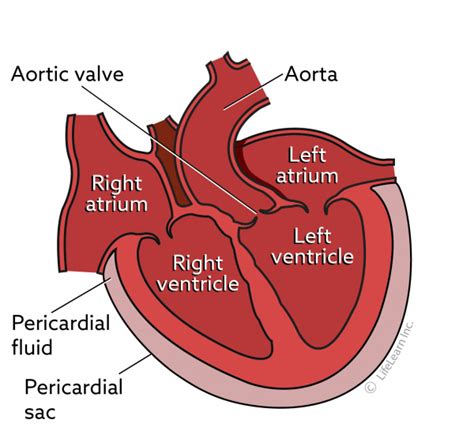 Pericardial Effusion In Dogs Vca Animal Hospital