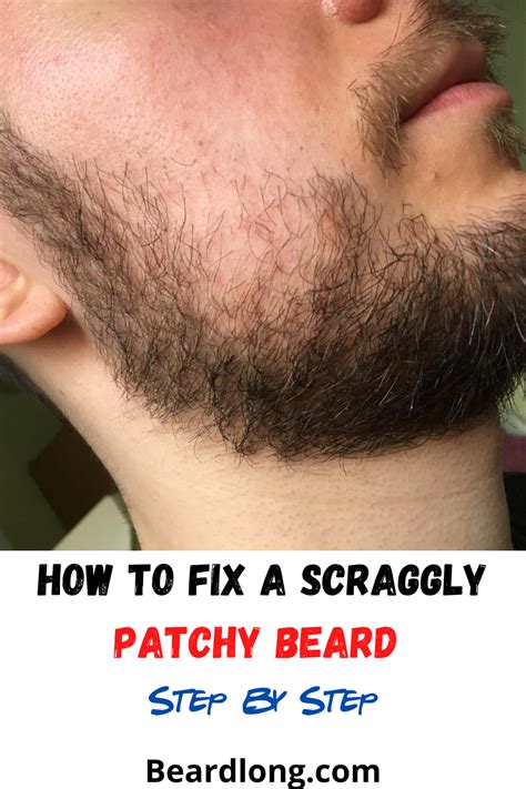 How To Fix A Patchy Beard Patchy Beard Beard Tips Grow Beard