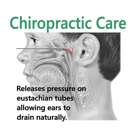 Chiropractic Helps With Ear Infections Chiropractic Chiropractic