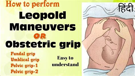 Leopolds Maneuvers In Hindi Obstetrical Grip What Are The 4 Type