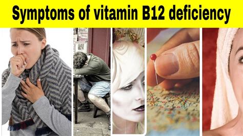 Symptoms Of Vitamin B Deficiency Vitamin Rush