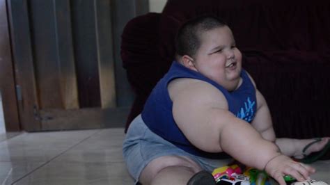 Seltene Hormon Störung Dreijähriger Junge Wiegt Schon 70 Kilo News
