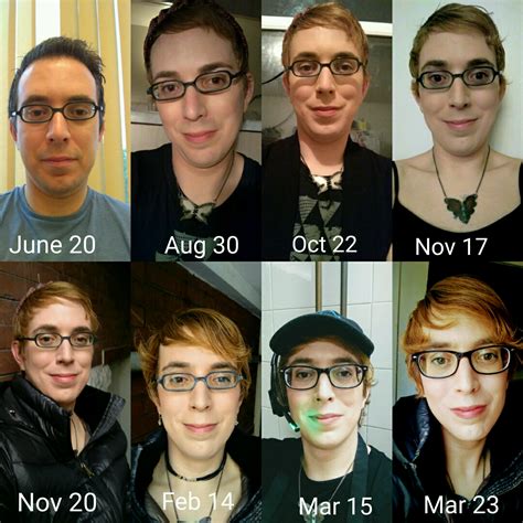 My timeline, day 1 of hrt to 9 months. How am I doing? : r/transtimelines