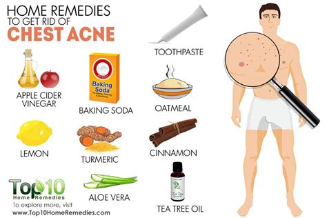 Home Remedies To Get Rid Of Chest Acne Top 10 Home Remedies