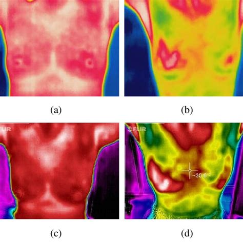 Thermal Images Obtained From A B Flir A320 And C D Flir One Download Scientific