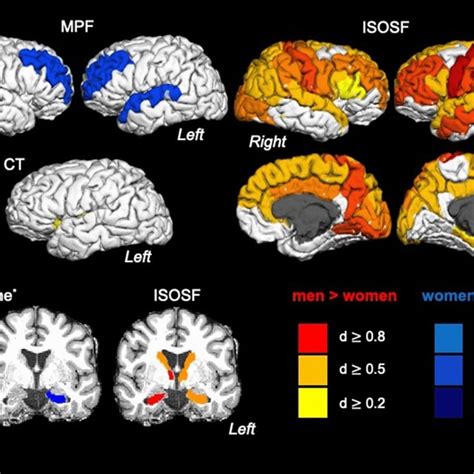 Displays The Effects Of Sex On Cortical Thickness Ct Subcortical Download Scientific Diagram