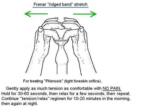 how to tension tight foreskin information