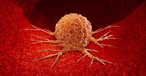 10 Types Of Malignant Tumors Facty Health