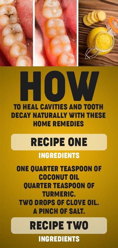 Also known as endodontics, root canal treatment aims to. How To Heal Cavities And Tooth Decay Naturally With These ...