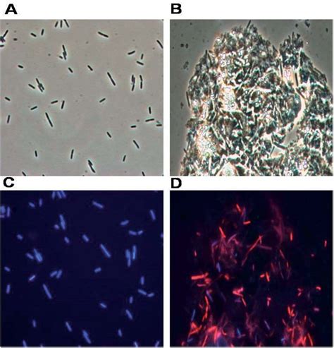 Microscope E Coli Bacteria Cell Micropedia