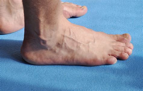12 Things Your Feet Can Tell You About Your Health