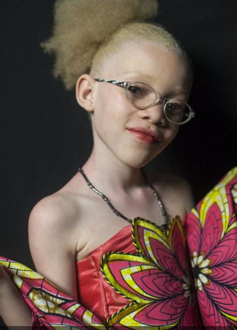 La Beauté De La Femme Ndundu Albinos